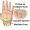 carpal-tunnel-syndrome-300x231